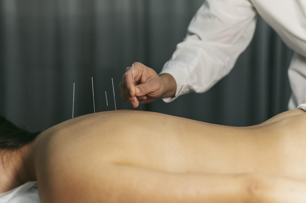 Acupuncturist in Emmen