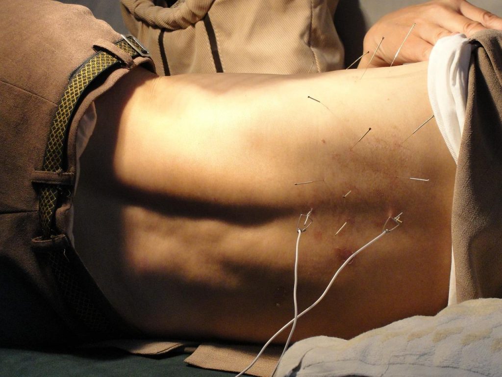 Acupuncturist in Emmen